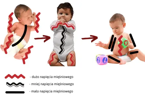 Zmiana napięcia mięśniowego u niemowląt: od wzmożonego napięcia obręczy barkowej do swobodniejszych ruchów.
